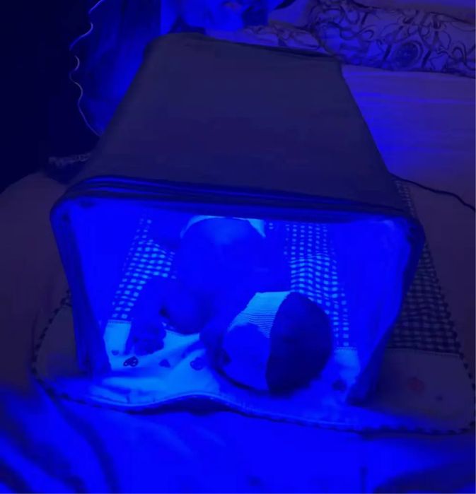 Прокат лампа від жовтяниці жовтухи новонароджених, лампа от желтушки