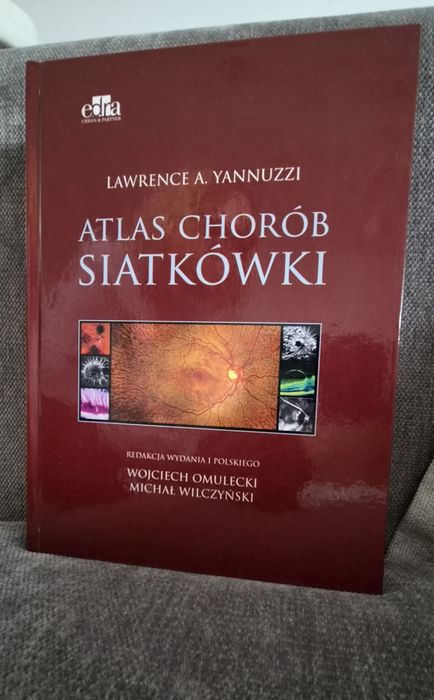 Atlas chorób siatkówki