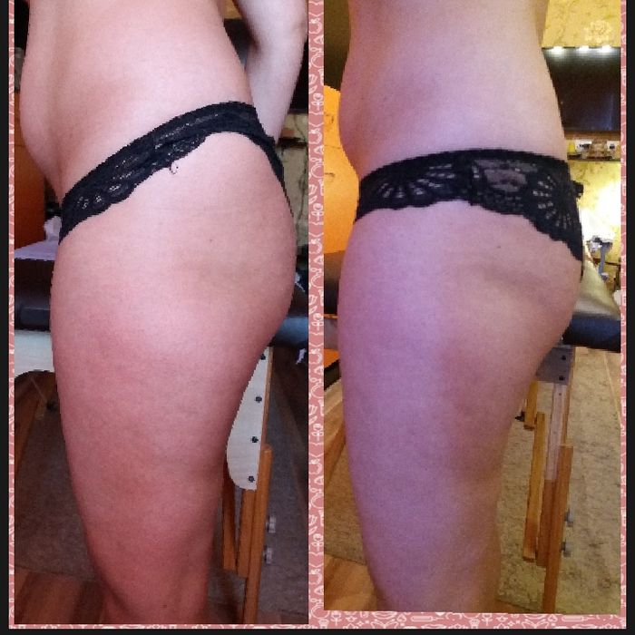 Косметолог естетист. Метро КПІ