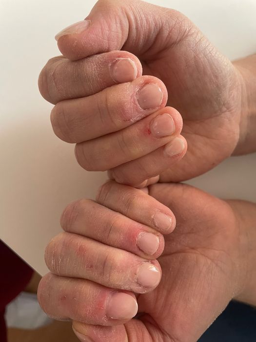 Modelos unhas de gel