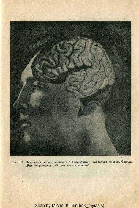 Патокинография в психиатрии и невропатологии | Сухаребский Лазарь 1936
