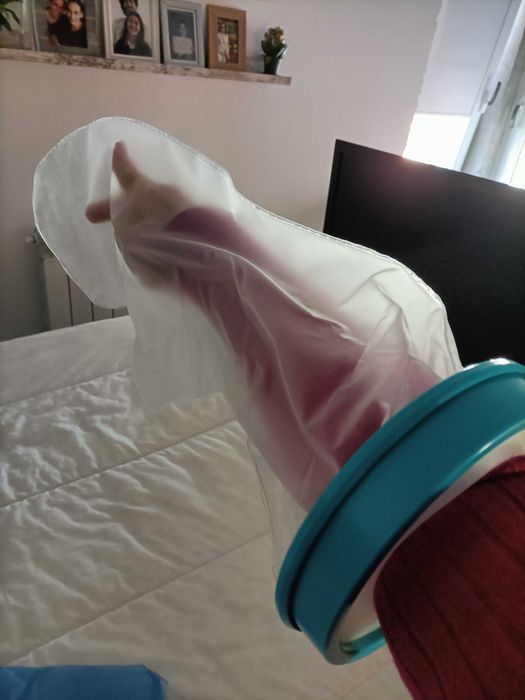 Manga plástica para proteção de braço com gesso