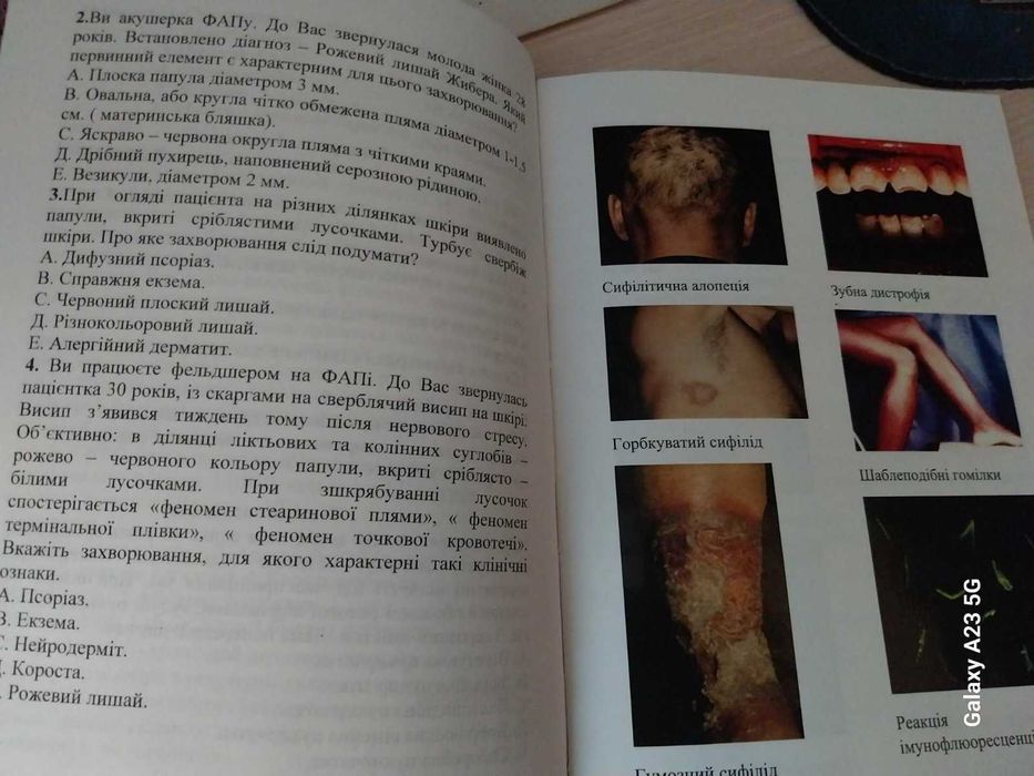 Навчальний посібник Дерматологія та венерологія