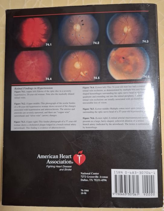 Hypertwnsion Primer, Second Edition, American Heart Association.