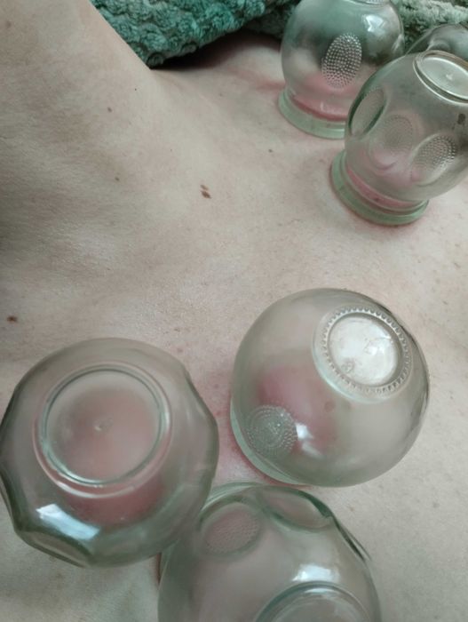 Terapia bańka ogniowa MiM Harmonia