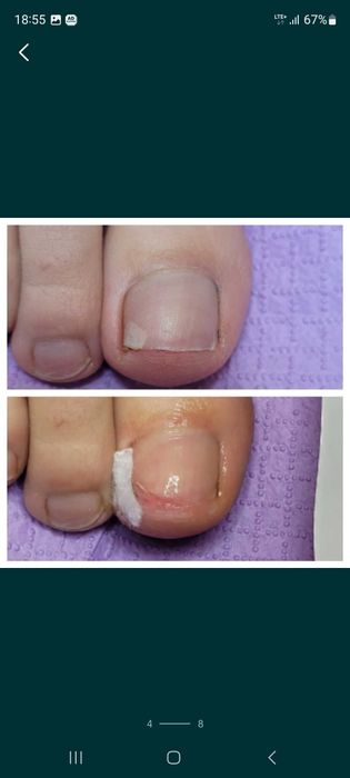 PODOLOG MOBILNY  Rataje  CAŁY POZNAŃ dla Seniorów Dojaz Pedicure