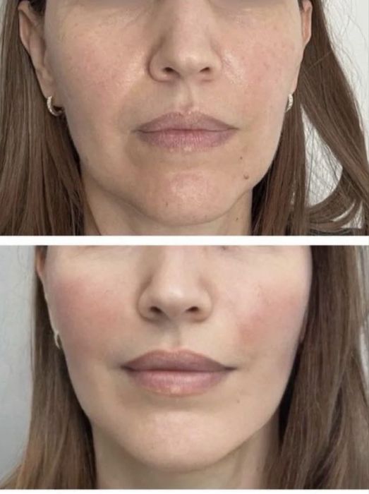 Косметология,. Массаж. Днепр.  пр. Слобожанский