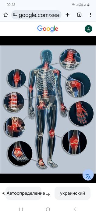 Лікування суглобів, хребців та онкології без операції