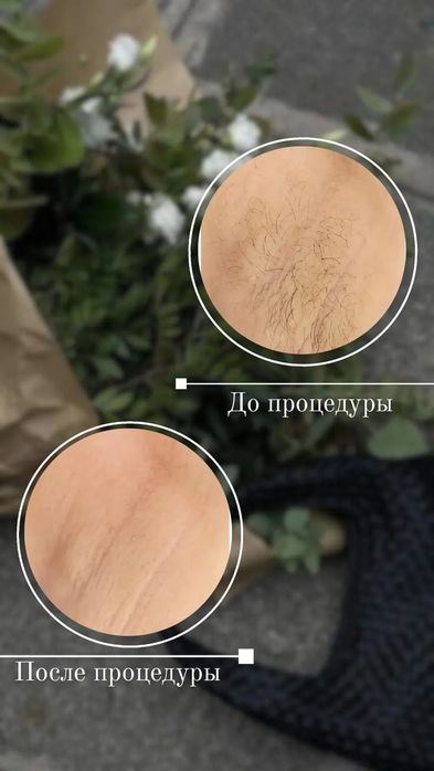 Воскова депіляція