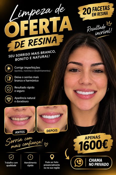 20 Facetas em Resina — Oferta Especial | Sorriso Renovado
