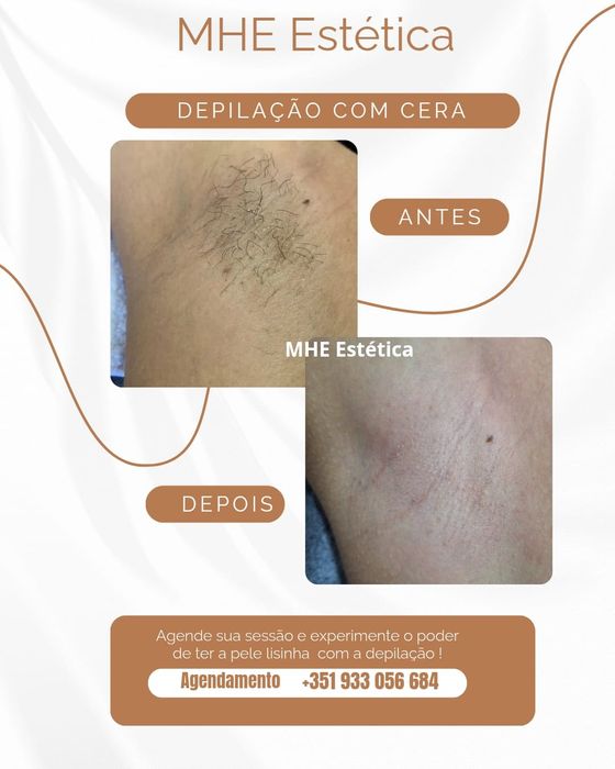 Depilação femenina e masculina