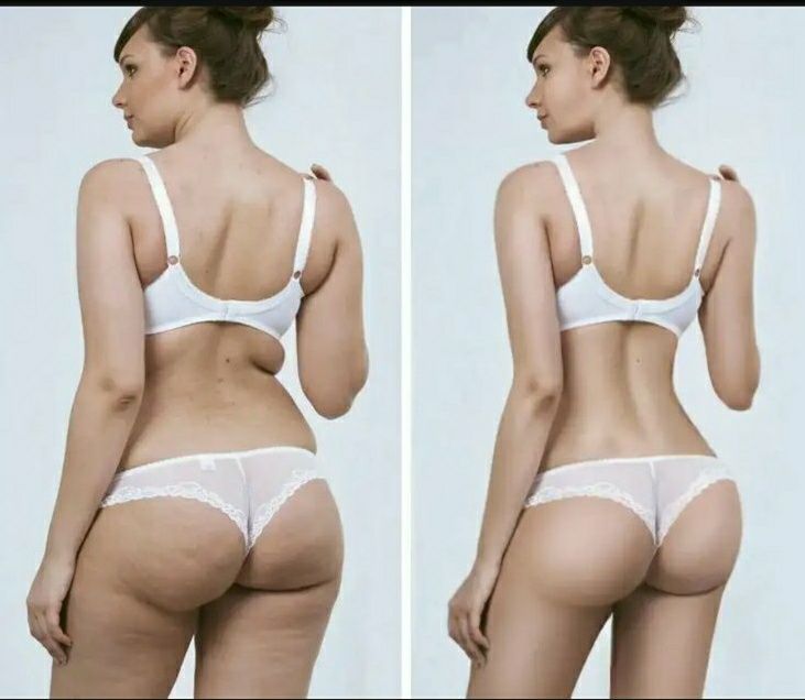 Реалicтичний фотошоп, полiпшення фото, будь-якi змiни на фото.
поліпше