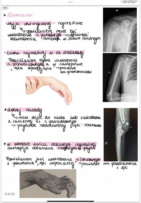 Własnorecznie robione notatki z anatomii