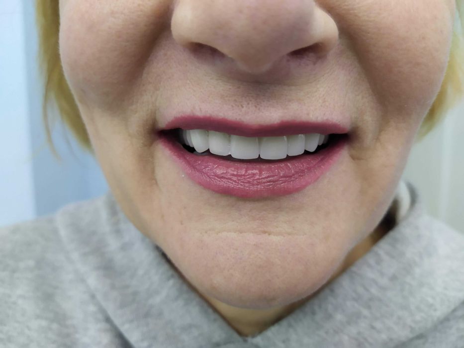 Стоматология. Протезирование .Имплантолгия