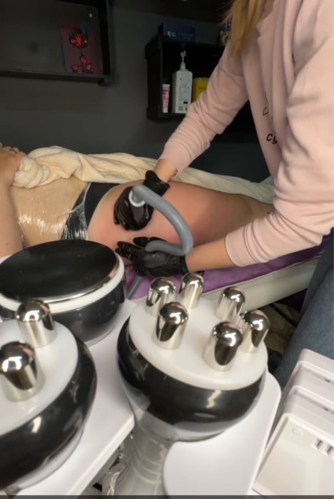 Масаж Апаратний Корекція фігури Вакуумно-роликовий масаж,