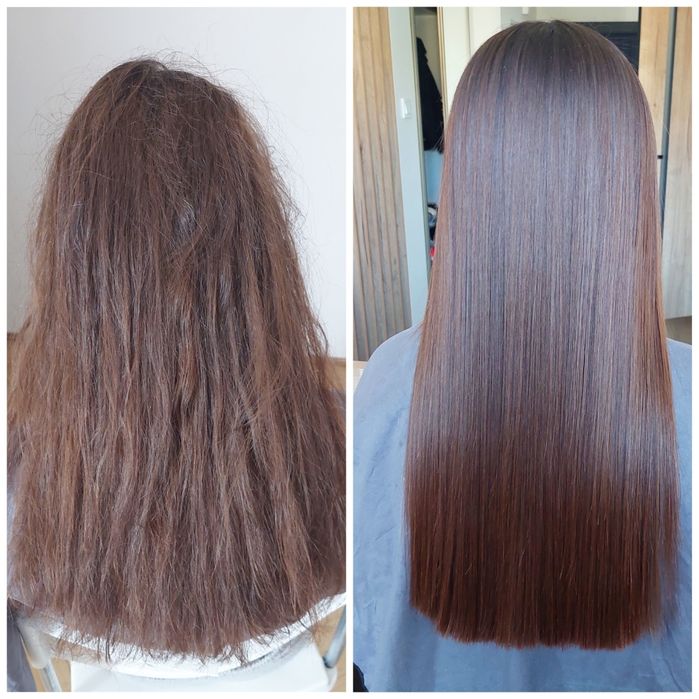 Keratynowe prostowanie, Krioterapia, NANOPLASTIA, Botox