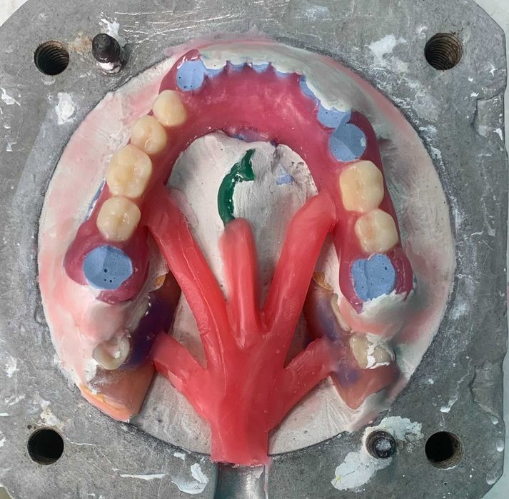 Инжекция нейлоном Acron Vertex Acetal