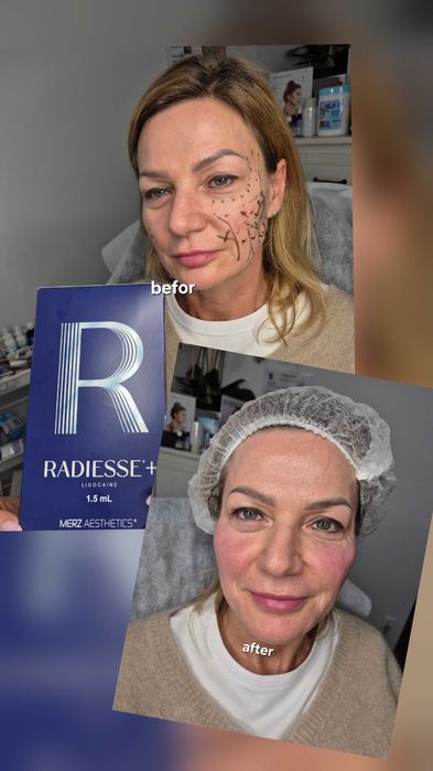 Услуги врача косметолога