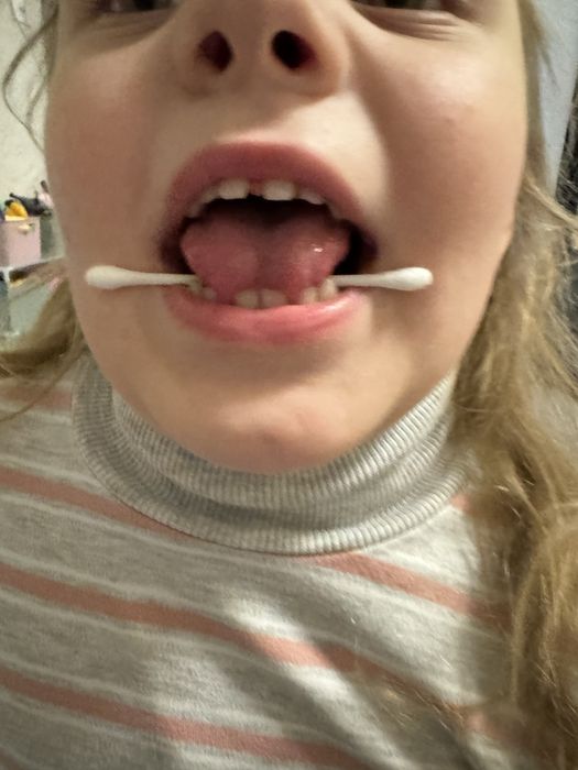 ЛОГОПЕД. Запуск мовлення. Звуки. Речення