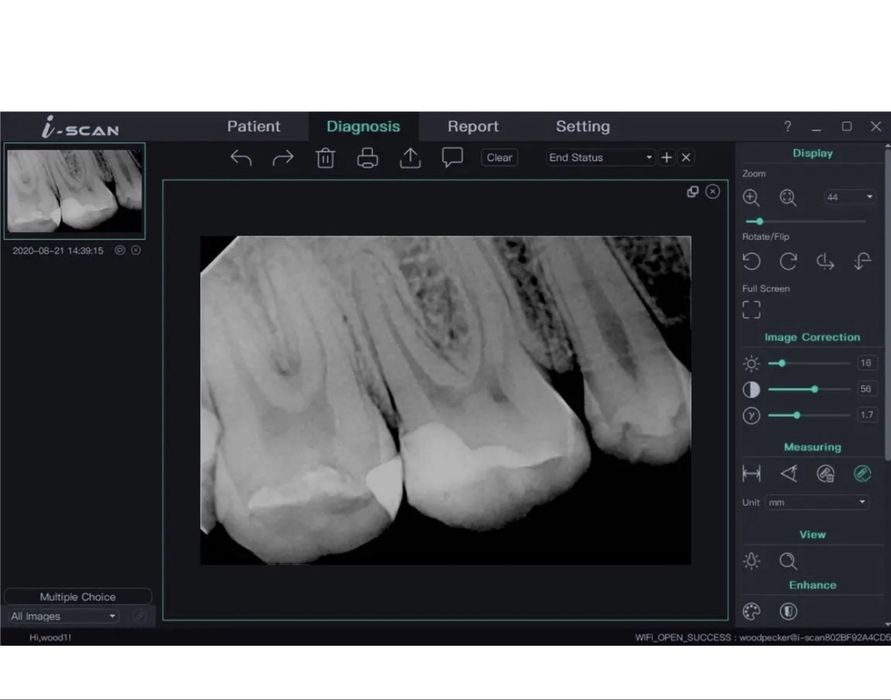 Візіограф Woodpecker i-sensor H2 з файлом додатку