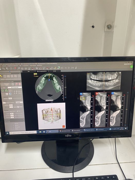 Компʼютерний томограф NewTom Giano