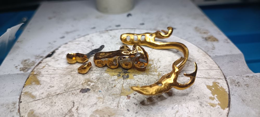 Стоматологическая позолота коронки