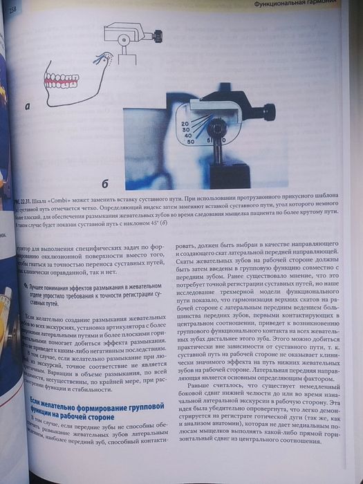 Функциональная окклюзия. Доусон. Стоматология. Гнатология