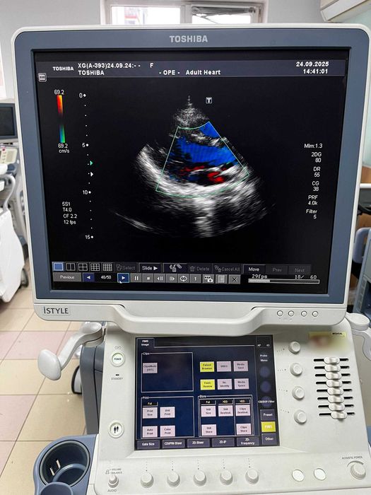 УЗД апарат Toshiba (Canon) Aplio XG