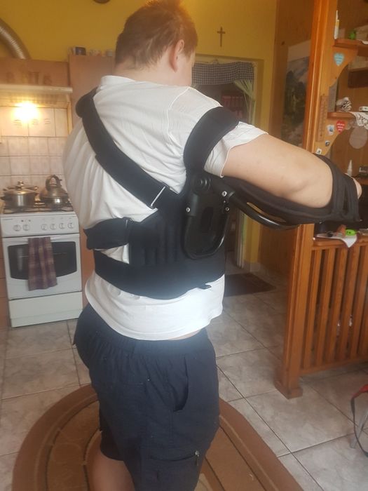 Orteza Kończyny Górnej Barku