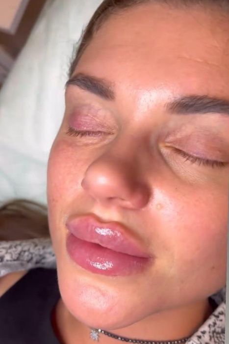 Увеличение губ ,индивидуальный подход. Сертифицированные препараты