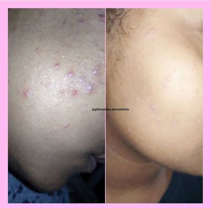 Estética Facial e Corporal Avançada/ EXCLUSIVO para MULHERES