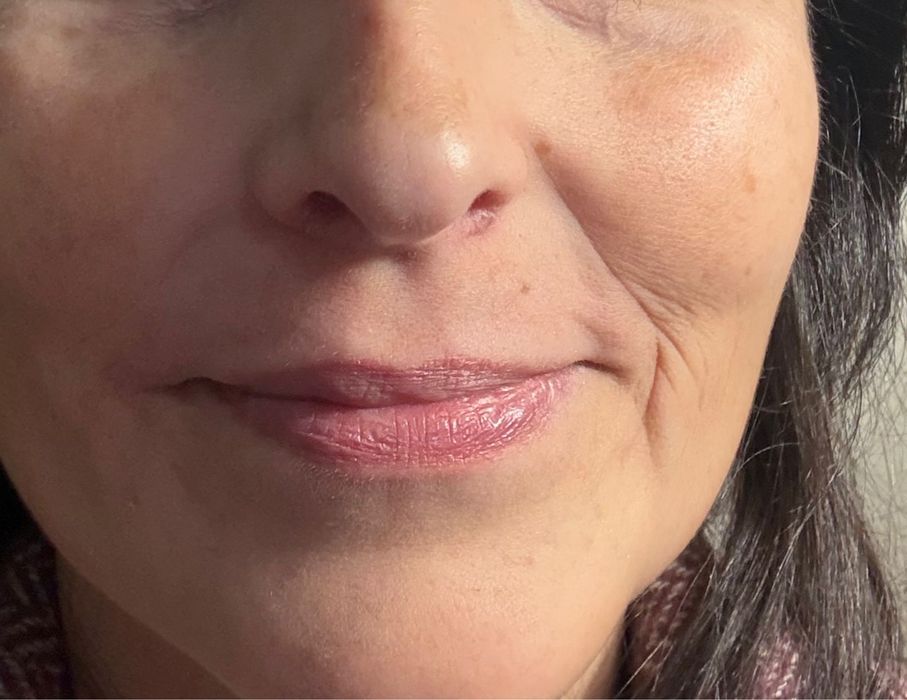 Epilação à linha ao domicilio