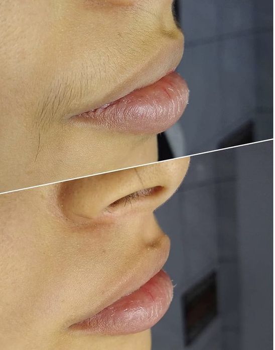 Design de Sobrancelhas + Buço | Promoção em Almada