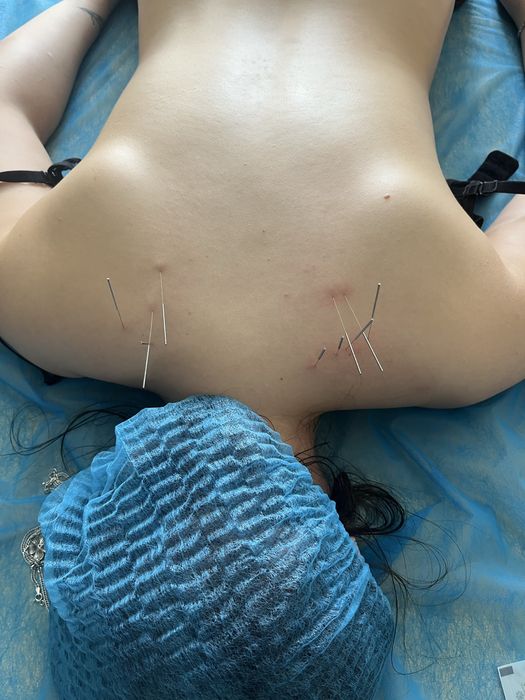 Послуги реабілітолога(online) послуги масажиста