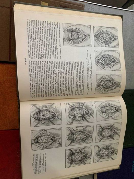 ЛОТ медицинские книги по нефрологии и урологии