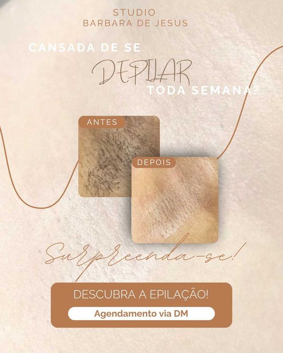 Epilação a cera
