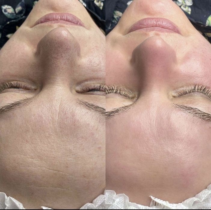 Косметолог Черноморск