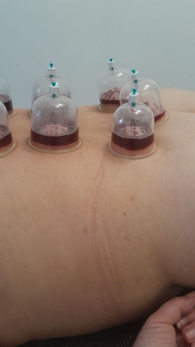 Масаж.Пресотерапія.Хіджама.