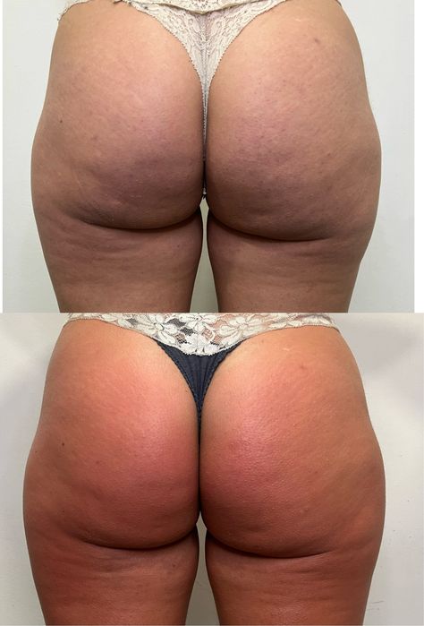 Massagem modeladora, Drenagem linfatica, Terapeutica...