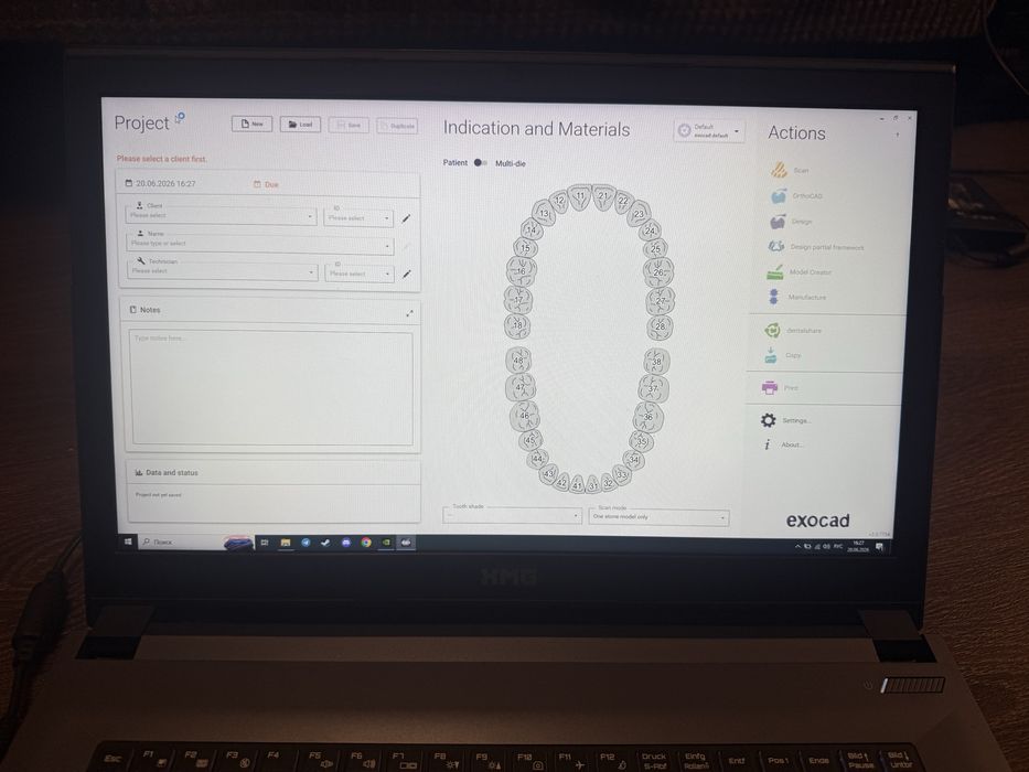 Ноутбук XMG A707 (N870HK1) з встановленим Exocad 3.0