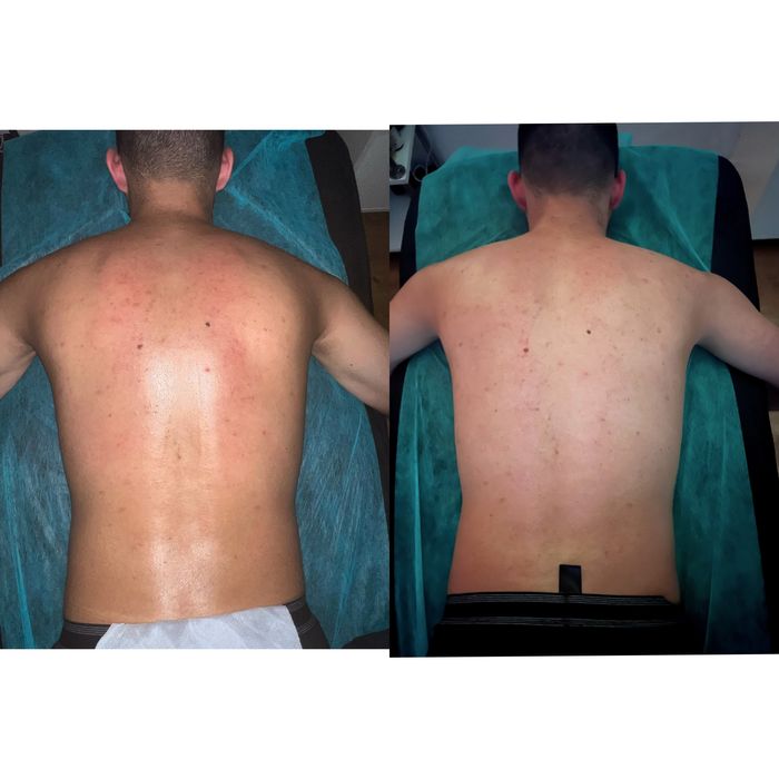 Массаж Днепр, Класический , лечебный, масаж, левый берег! Массажист