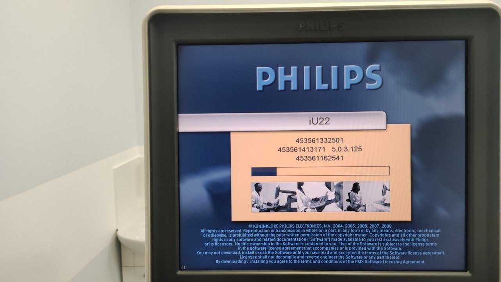 Апарат УЗД (УЗИ аппарат) Philips IU22