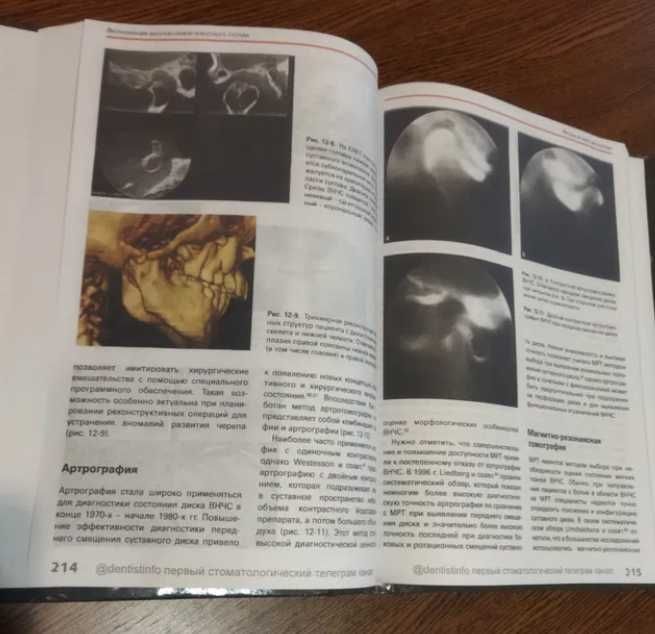 NEW‼️ Височно-нижнечелюстные расстройства Стоматологічні книги гнатоло
