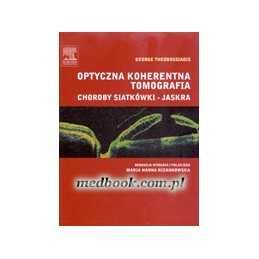 Theodossiadis -Optyczna koherentna tomografia Choroby siatkówki-jaskra