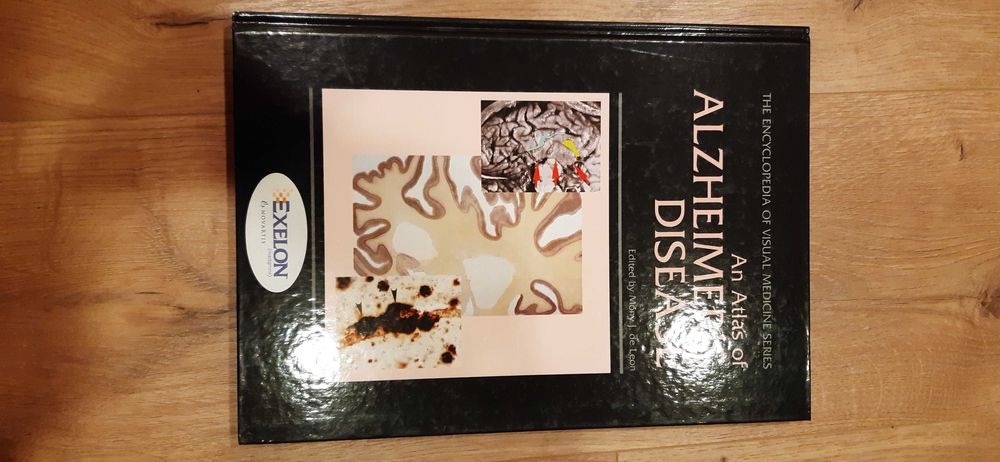 Livro Atlas of Alzheimer's disease