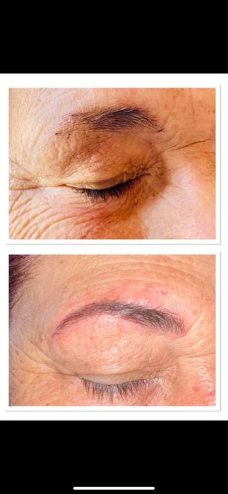 Migroblading fio a fio