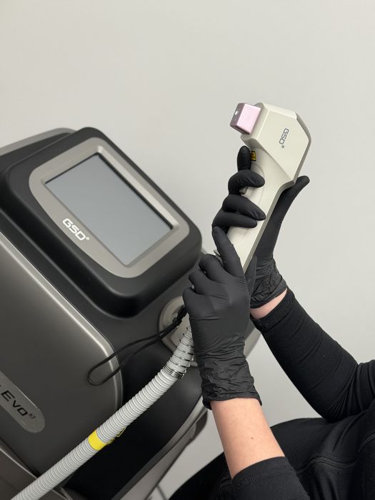 Depilacja laserowa 99zł