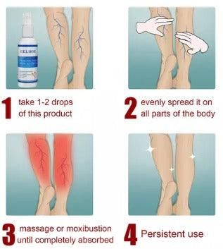 Spray para varizes 30ml