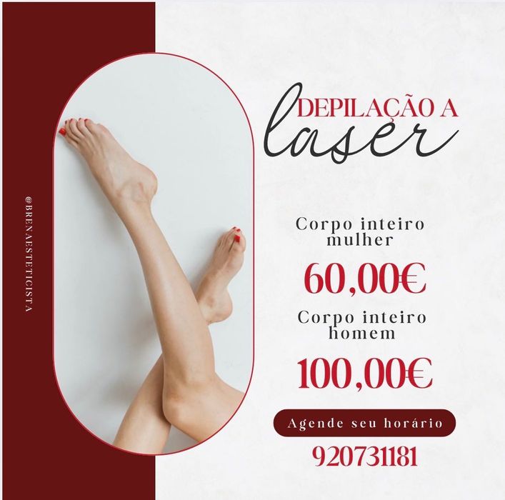 Epilação a laser