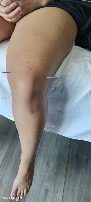 Професійний масаж Никополь